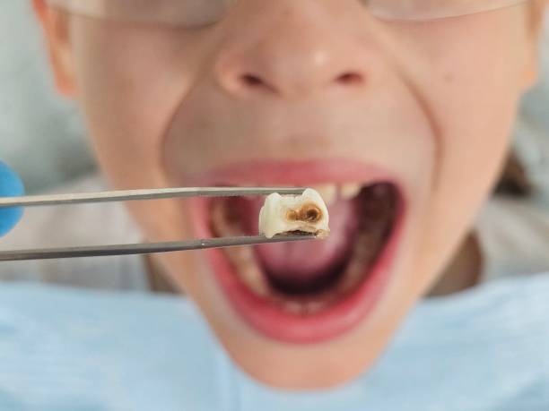 Best Emergency Treatment for Toothache in Little Rock, AR